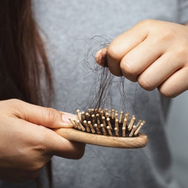 CADUTA DEI CAPELLI: CAUSE E 11 ALIMENTI PER PREVENIRLA